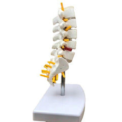 Lumbar Spine Model with Herniated Disc Sacrum & Nerves for Medical Education