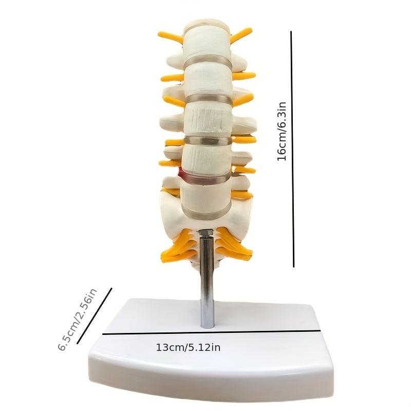 Lumbar Spine Model with Herniated Disc Sacrum & Nerves for Medical Education