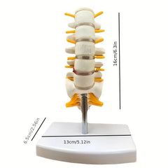 Lumbar Spine Model with Herniated Disc Sacrum & Nerves for Medical Education