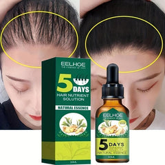30ml Ginger Hair Care Essential Natural Essence for Hair Nutrition Repair