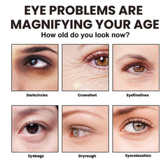 Crocodile Eye Cream Reduces Wrinkles Moisturizes Dark Circles