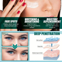 Dark Spot Fade Cream for Underarm Neck Back Legs - 100% Natural Ingredients
