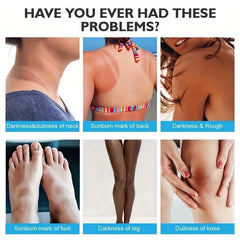 Niacinamide Body Concealer Cream for Even Skin Tone
