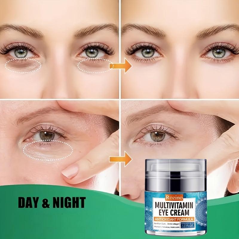 Moisturizing Eye Cream for Dark Circles, Bags & Aging Eyes