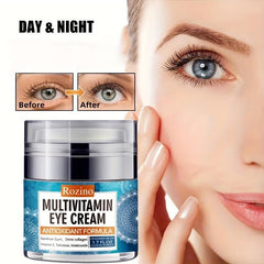 Moisturizing Eye Cream for Dark Circles, Bags & Aging Eyes