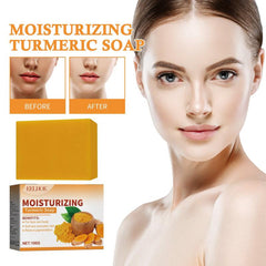 2pcs 100g Turmeric Radiant Skincare Soap for Elbows Knees