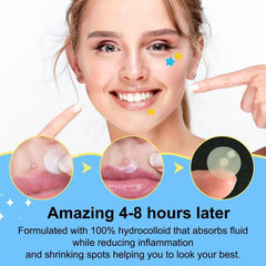 Acne Patch Hydrocolloid Spot Stickers for Face Skin