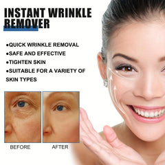 30ml Retinol Wrinkles Removal Face Cream