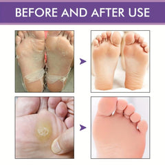 Lavender Foot Peeling Mask 2 Pairs Soft Skin Foot Spa Women Foot Care