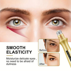 Eye Roller Essence for Fine Lines & Wrinkles, Dark Circles, Tightens Skin