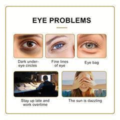 Eye Roller Essence for Fine Lines & Wrinkles, Dark Circles, Tightens Skin