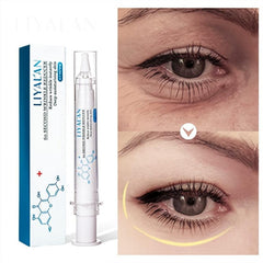 Eye Cream for Bagginess, Puffiness, Dark Circles, Wrinkles