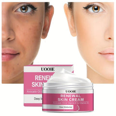Deep Moisturizer Cream 30g Avocado Vit E C Night Moisturizing Cream
