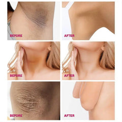 30ml Private Cover Cream - Remove Melanin from Private Areas
