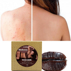 3pcs 100g Private Parts Care Soap Gentle Cleansing and Smoothing