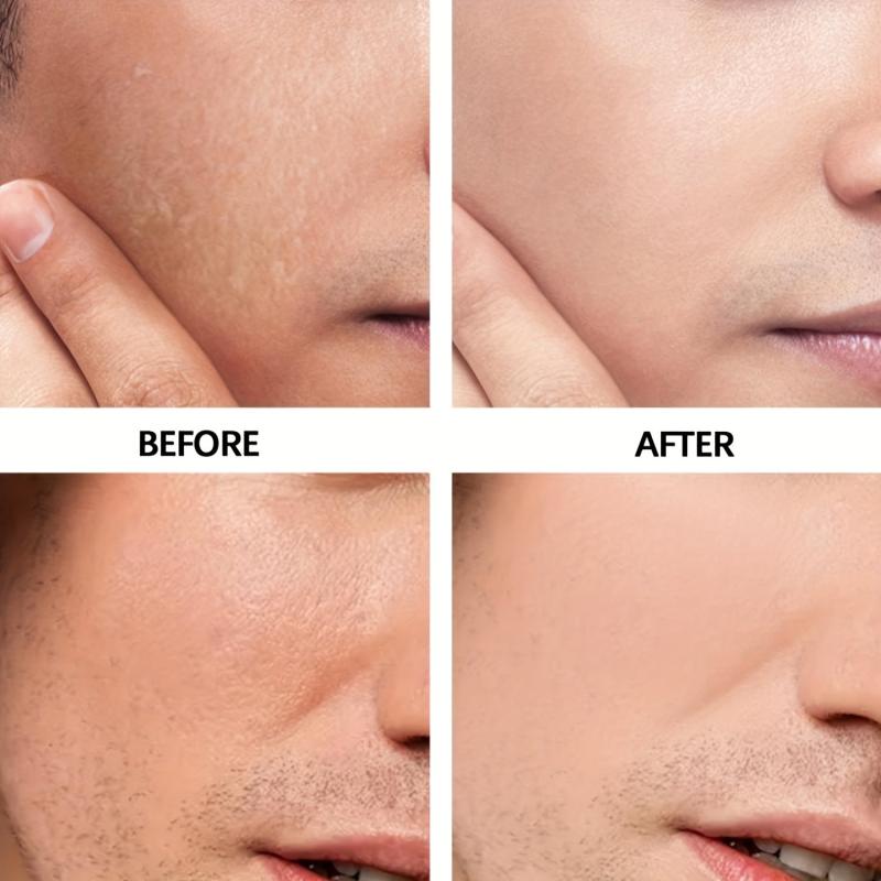 Hydrating Moisturizing Cream for Dry Skin with Hyaluronic Acid & Ceramides