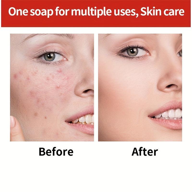 3pcs Ginseng Soap Moisturizing Nourishing Skin Cleansing Soap