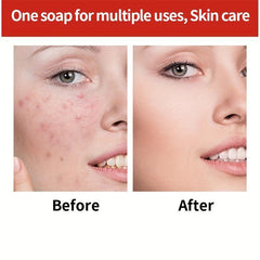 3pcs Ginseng Soap Moisturizing Nourishing Skin Cleansing Soap