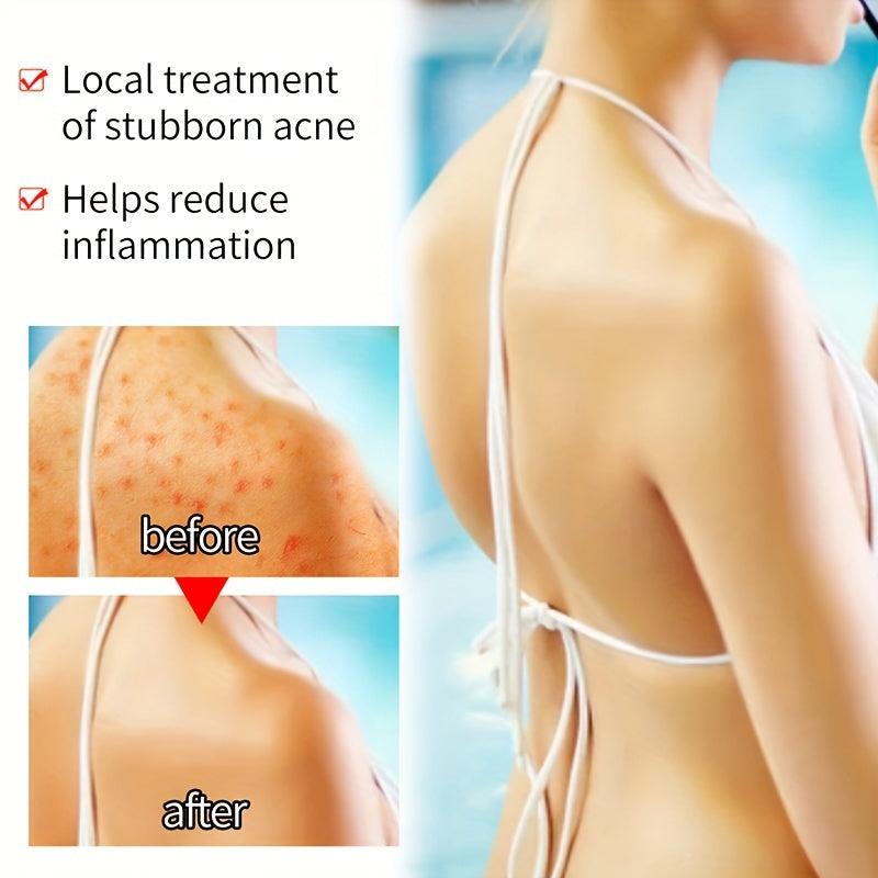 Turmeric Acne Dark Spot Removal Olive Coconut Cleanser