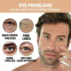 Men's Eye Roller Cream for Dark Circles & Bags 10ml