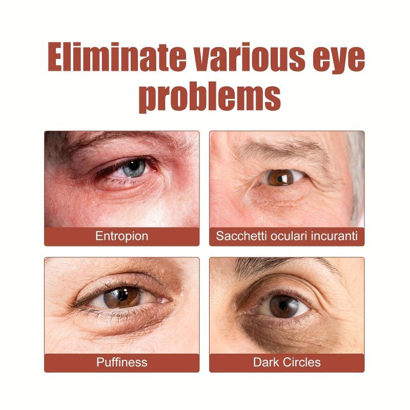 Eye Cream for Fine Lines & Dark Circles