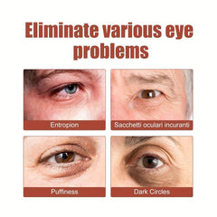 Eye Cream for Fine Lines & Dark Circles