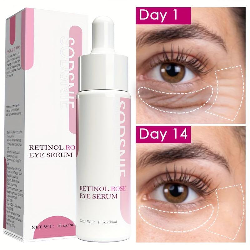 30 Ml Retinol Rose Eye Serum Rejuvenate Skin Dullness Moisturizing