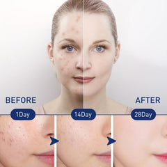 Exfoliating Foam Mousse Cleanser