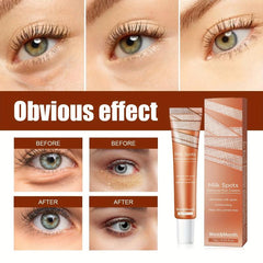 Chestnut Repair Eye Cream - Deep Pore Cleansing & Acne Reduction