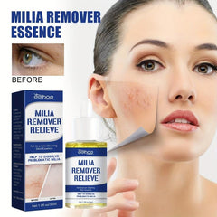 Chestnut Repair Eye Cream - Deep Pore Cleansing & Acne Reduction