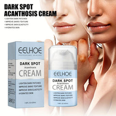 Dark Spot Ratcheting Cream Underarm Body Lotion