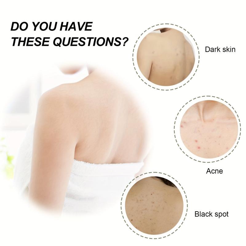 Acne Treatment Cream - Deep Cleansing & Moisturizing Exfoliator