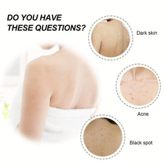 Acne Treatment Cream - Deep Cleansing & Moisturizing Exfoliator