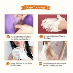 Africa Soap Bar for Acne Eczema Psoriasis Scar Removal