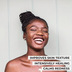 Africa Soap Bar for Acne Eczema Psoriasis Scar Removal