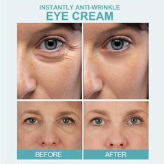 Instant Wrinkle Diminishing Eye Cream - Fade Fine Lines, Dark Circles, Hydrating