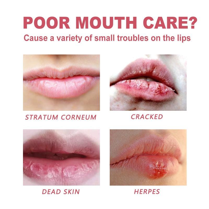 Lip Care Set: Moisturizing, Repairing, Prevents Cracking