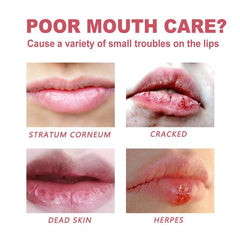 Lip Care Set: Moisturizing, Repairing, Prevents Cracking