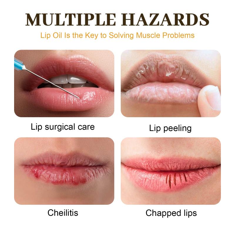 Honey Lip 5g Moisturizing Lip Care Prevents Dryness