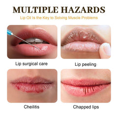 Honey Lip 5g Moisturizing Lip Care Prevents Dryness