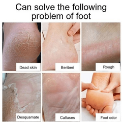 Moisturizing Foot Repair Cream for Dry Skin Hands Feet Heels