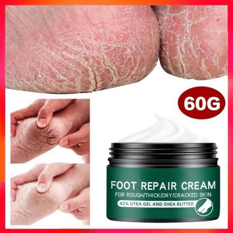 Moisturizing Foot Repair Cream for Dry Skin Hands Feet Heels
