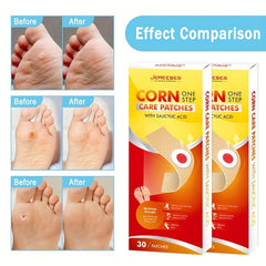 Salicylic Acid Corn Remover - Callus & Corn Removal Treatment
