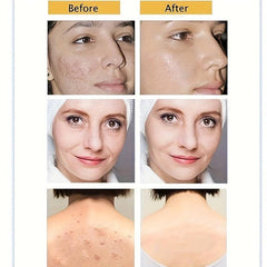 Yeast Soap with Hyaluronic Acid, Vitamin C, Retinoic Acid, Collagen 65g