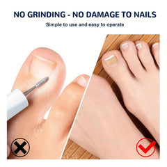 Ingrown Toenail Correction Stickers for Dark Skin Tone