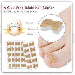 Ingrown Toenail Correction Stickers for Dark Skin Tone