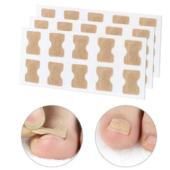 Ingrown Toenail Correction Stickers for Dark Skin Tone