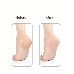 Portable Pumice Stone Foot File for Smooth Feet