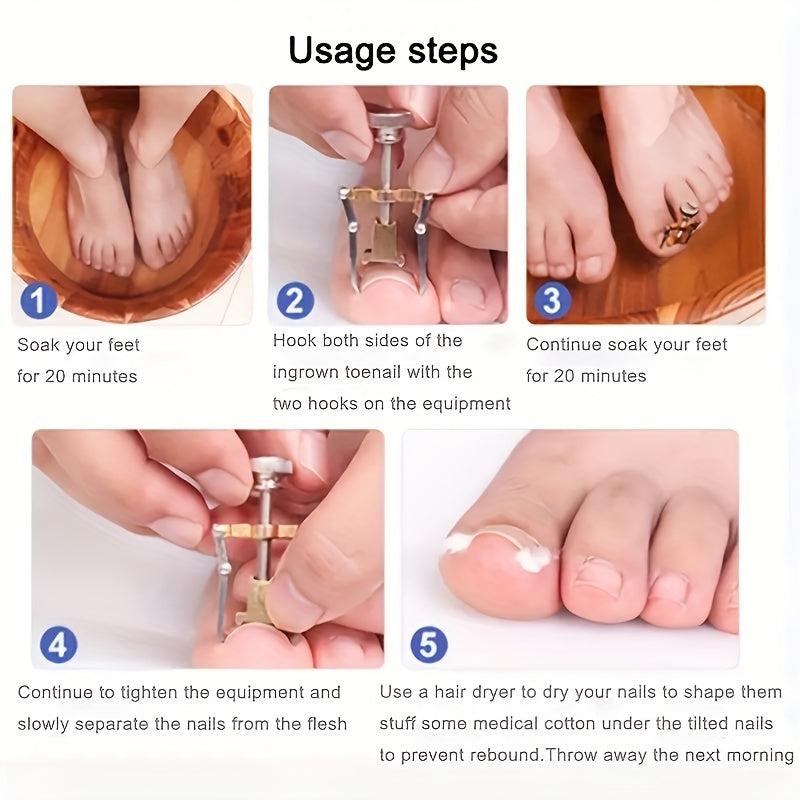 Ingrown Toenail Correction Straightening Clip Toe Nail Correction