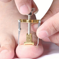 Ingrown Toenail Correction Straightening Clip Toe Nail Correction